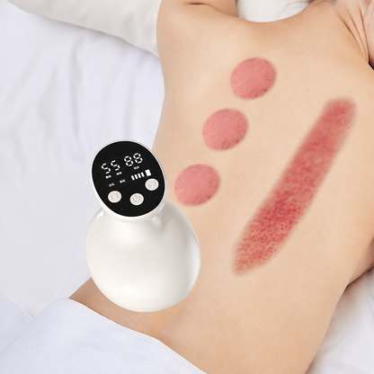🧘 Elektrischer Gua-Sha-Massager – tragbar, heizbar & mit Vakuum-Funktion, ideal für Schröpfen, Entspannung & den täglichen Gebrauch 🏠